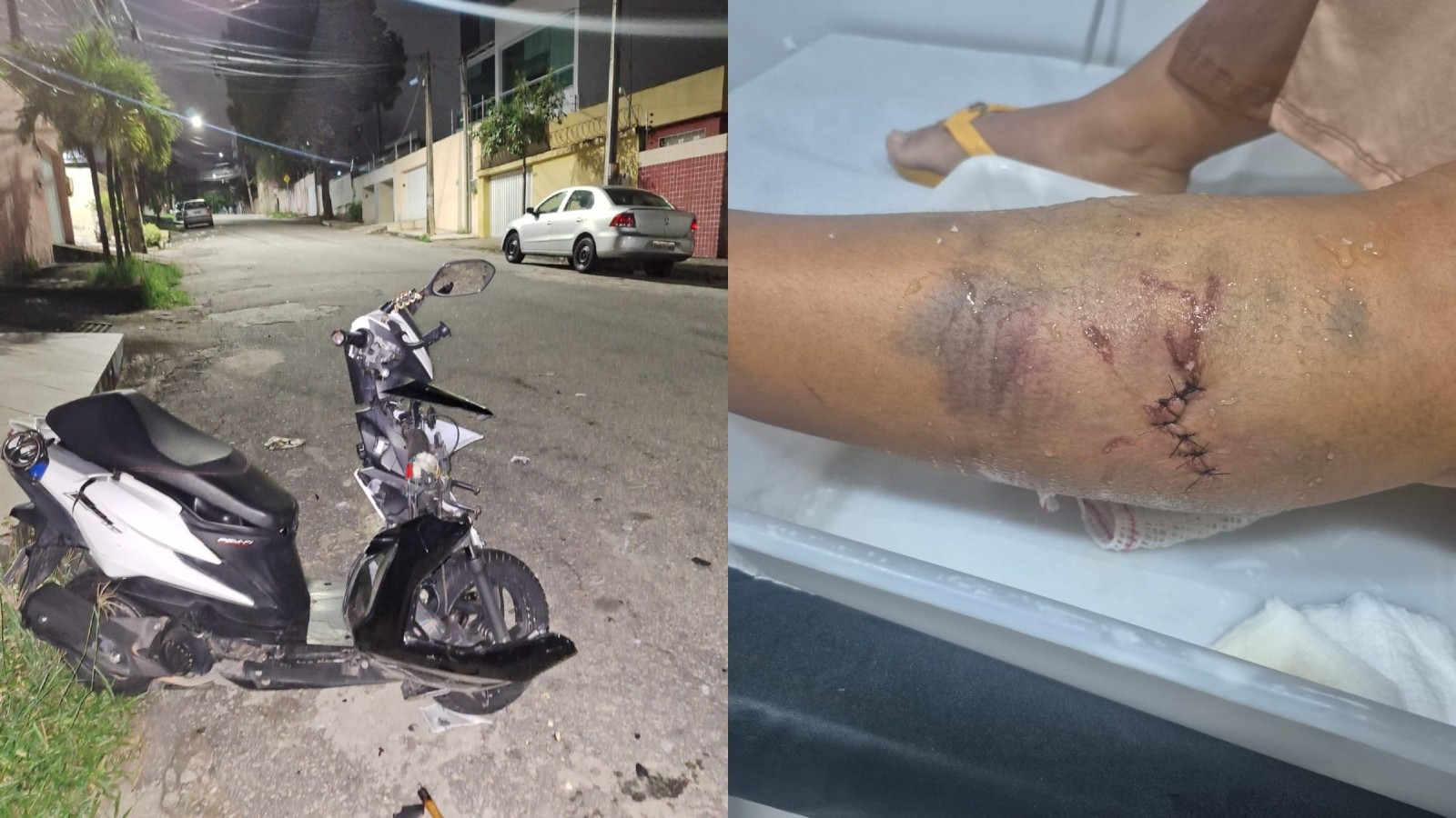 Músico é preso em Fortaleza após ex relatar atropelamento e agressões; polícia apura tentativa de feminicidio
