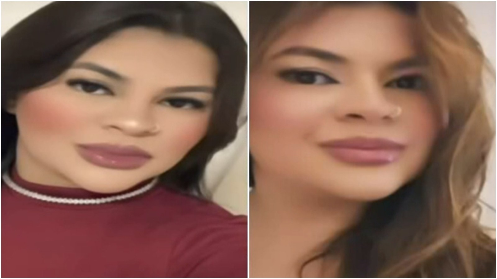 Após três cirurgias, jovem de 21 anos deixa UTI com mãos reimplantadas; vídeos revelam diálogo entre irmãos