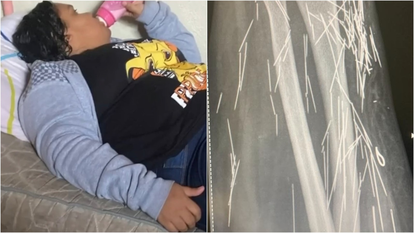 Mulher de 37 anos que fingiu ter 12 já havia denunciado pais por abusos e agulhas no corpo; prisão é convertida em preventiva