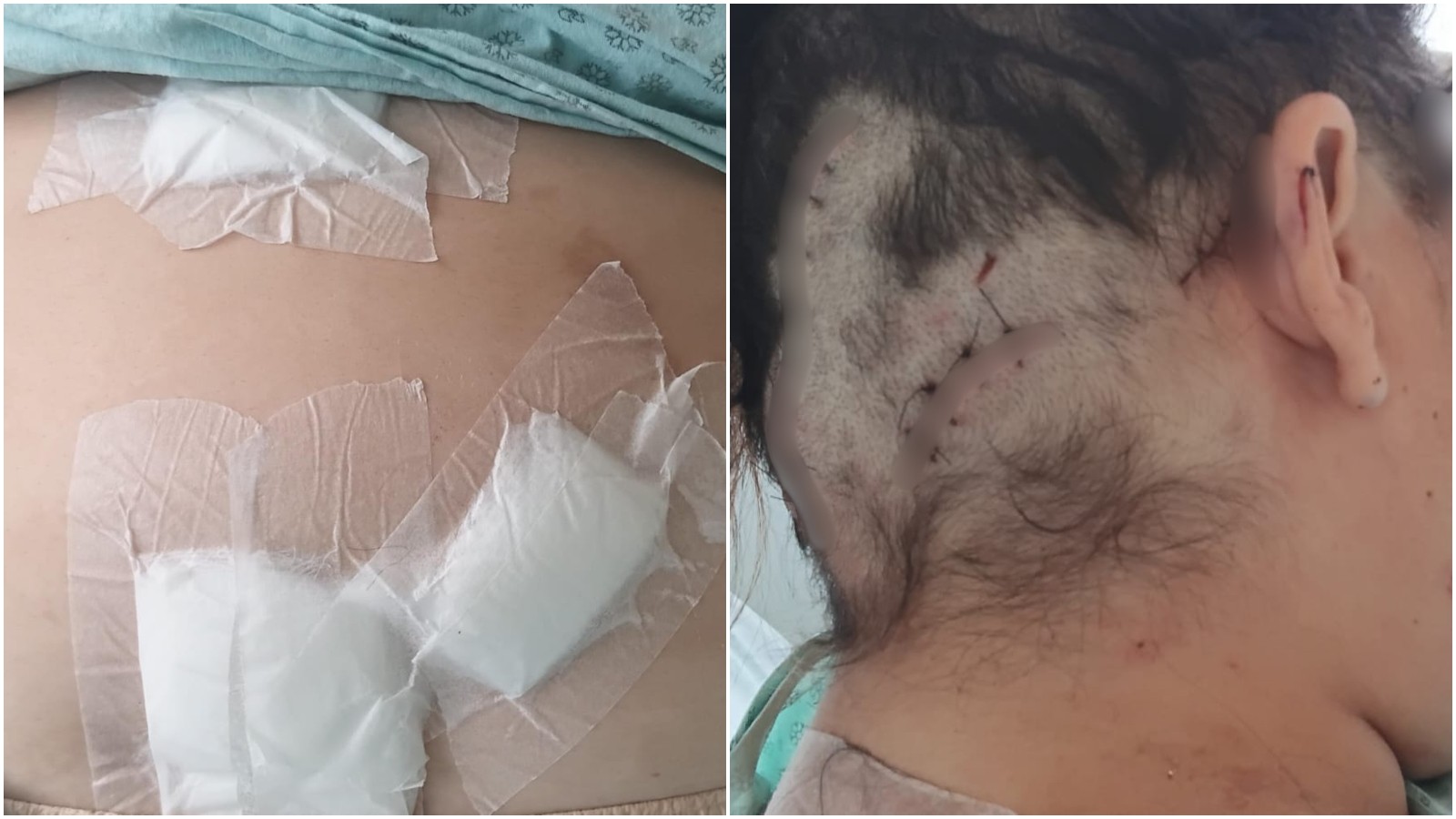 Mulher mantida em cárcere sobrevive a 12 facadas; suspeito é preso com pistola e drogas no Ceará
